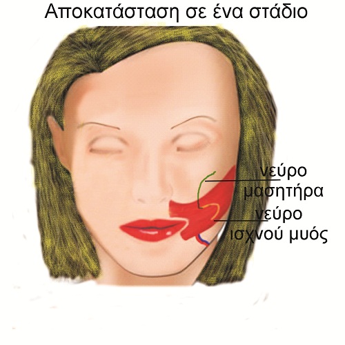 figure3 2