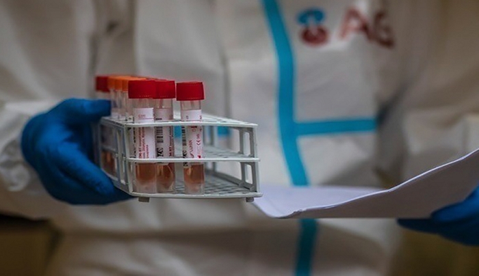 Κορωνοϊός: 16.274 νέα κρούσματα, 70 θάνατοι, 413 διασωληνωμένοι