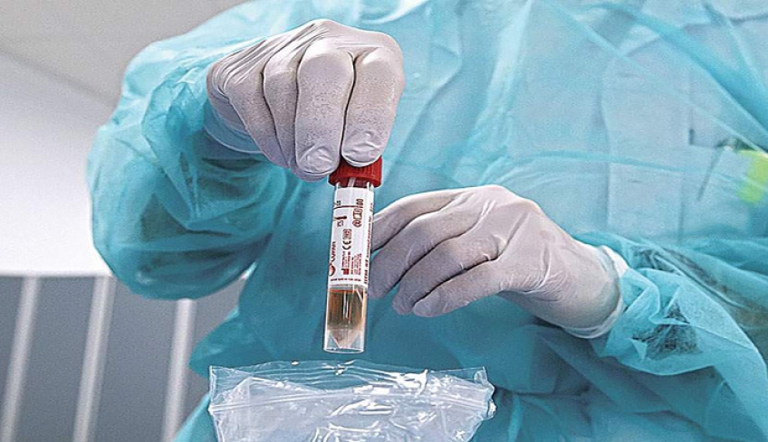 Κορωνοϊος 11.08.21: 99 νέα κρούσματα στην Π.Ε. Ρόδου - 11 στην Π.Ε. Καλύμνου – 11 στην Π.Ε. Κω