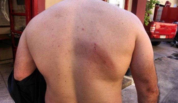 Καταδικάστηκε η τσιγγάνα για την επίθεση στους πυροσβέστες