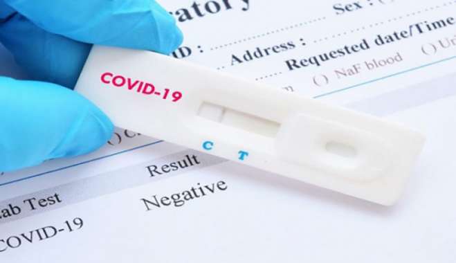 Συνεχίζονται τα test Covid-19 από την ΚΟΜΥ Κω έως την Παρασκευή 18 Νοεμβρίου.