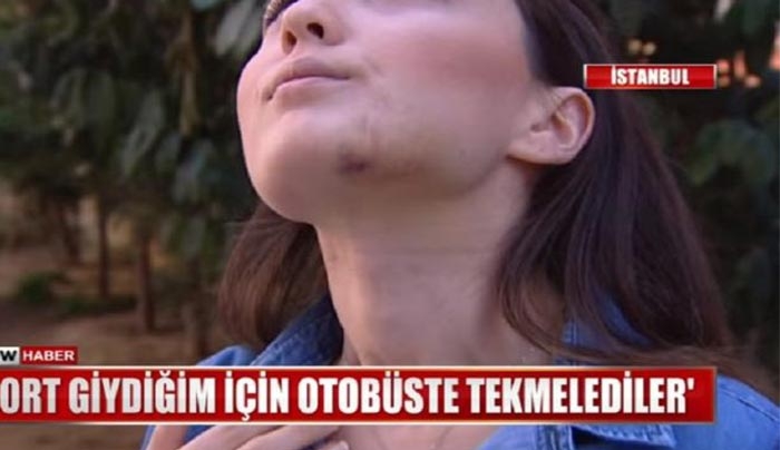 Γρονθοκόπησε άγρια, γυναίκα μέσα σε λεωφορείο, επειδή φορούσε σορτς (Βίντεο)