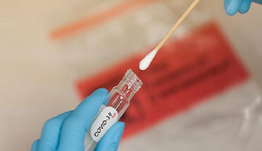 Δήμος Κω: Διαγνωστικός έλεγχος Covid-19 στην πόλη της Κω το Σάββατο 19/12 και στην Κέφαλο την Κυριακή 20/12