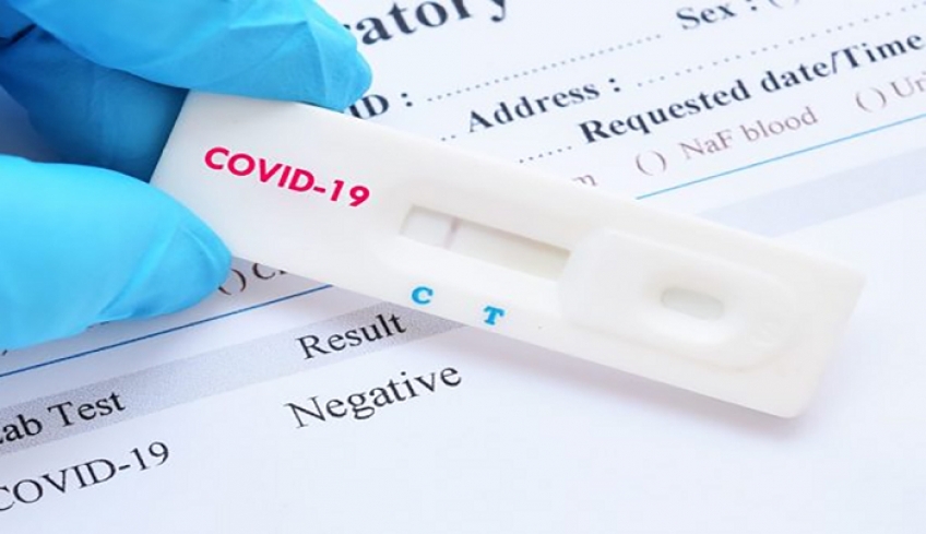 test Covid-19 από τον ΕΟΔΥ  συνεχίζονται στην πόλη και στις Κοινότητες