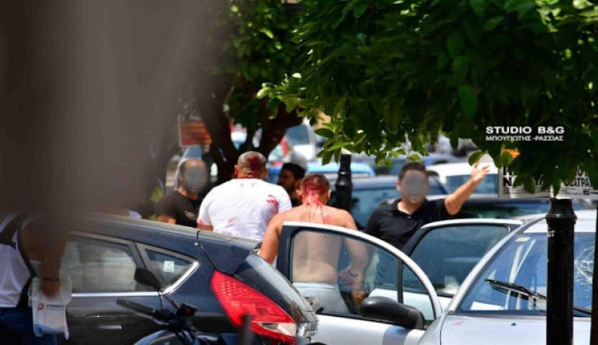 Ναύπλιο: Άγριο ξύλο και μαχαιρώματα έξω από το Εργατικό Κέντρο! Εικόνες που σοκάρουν